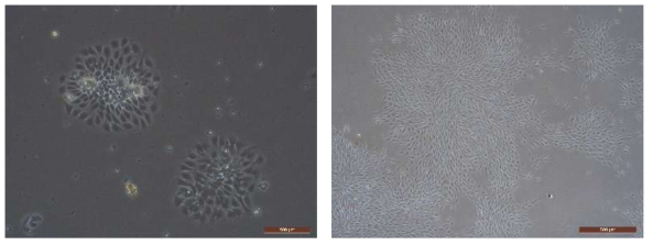 30일령 GTKO 돼지의 대동맥에서 혈관내피세포를 분리 후 배양 1일째(왼쪽)와 5일 째(오른쪽) 세포의 형태