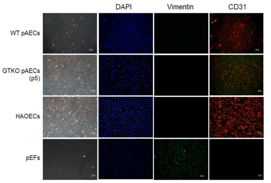 GTKO 돼지 impAECs의 혈관내피세포 특성 분석을 위한 대조군 세포의 형광 염색. 혈관내피세포 마커 CD31 항체와 섬유아세포 마커 Vimentin 항체를 사용하여 염색 후 형광 분석