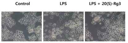 인삼 화합물 20(S)-Rg3에 의한 대식세포 형태 변화