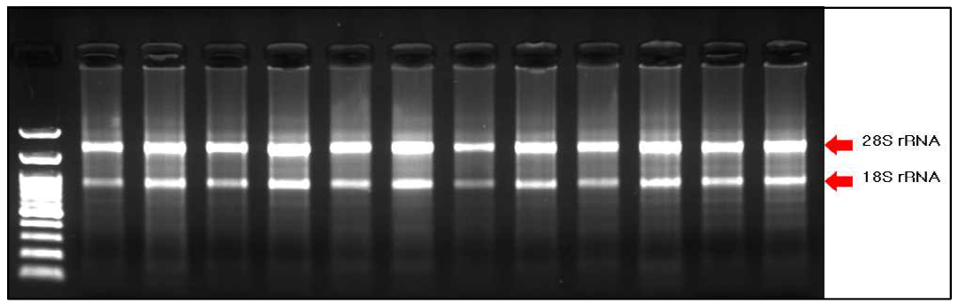 RNA 전기영동 결과 (1.5% agarose gel electrophoresis, 20min)