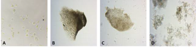 형태적으로 다른 조직의 원형질체 분리. A: 작은 구형의 embryogenic callus, B: 크기가 큰 direct embryo, C: 크기가 작은 direct embryo, D: 물기를 머금은 callus