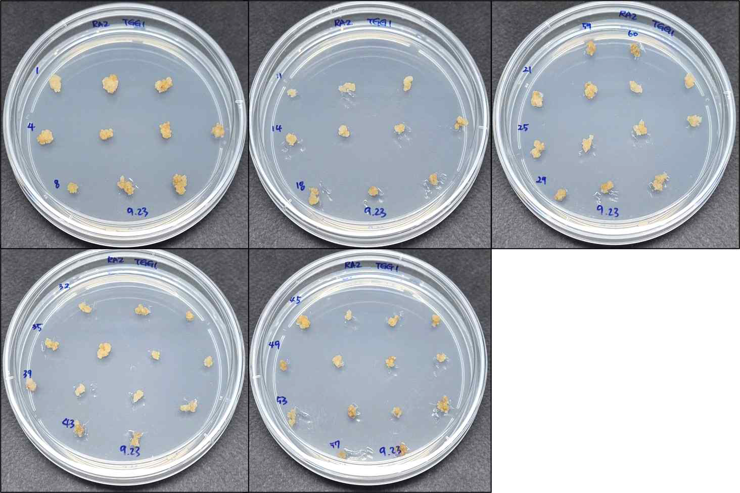 무 (RA2) 원형질체를 이용한 CRISPR/Cas9 RNP 도입 후 유도된 캘러스