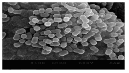 Acinetobacter calcoaceticus 4-2-2 균주의 주사전자현미경 사진