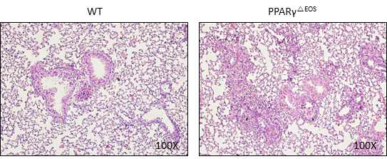 천식모델에서 WT과 PPARγ△EOS 마우스의 폐 내 면역세포 침투 비교