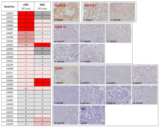 IHC screening for HER2 and EGFR expression in gastric patient-derived xenograft models