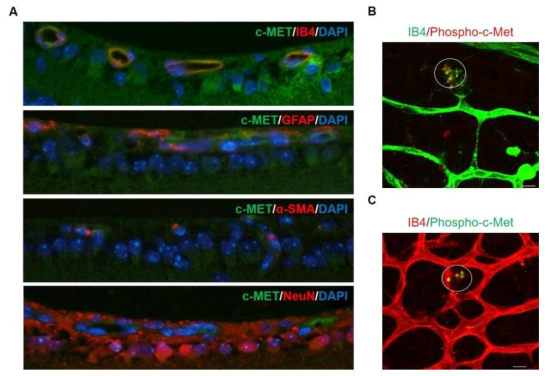 Expression and activation of c-Met in ocular tissues. (A) Expression of c-Met in the superficial layer of the retina. (B) Expression of the phosphorylated form of c-Met in the retinal vasculature at 6 hours after intravitreal injection of m4A25 (100 nM). (C) Expression of the phosphorylated form of c-Met in the retinal vasculature at 6 hours after intravitreal injection of RHM5 (100 nM)