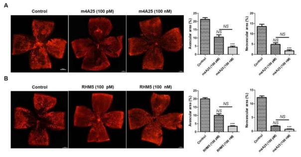 Effects of m4A25 and RHM5 on in vivo oxygen-induced retinopathy model. (A) The effects of m4A25 on in vivo oxygen-induced retinopathy model. (B) The effects of RHM5 on in vivo oxygen-induced retinopathy model