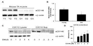 노화 의존성 CD146의 발현 감소 확인