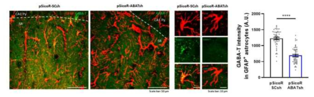 Astrocyte 특이적 GABA-T 조절이 가능한 바이러스의 뇌내 주입 (in vivo) 후 사진 및 결과 분석