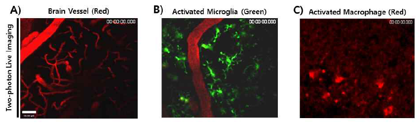 이광자현미경을 이용하여 뇌혈관 및 뇌염증 관여 세포 관찰