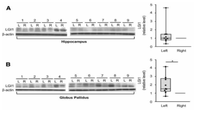 조직 기증자들의 사후 뇌 분석을 통해 좌측 Basal ganglia 에 특이적으로 LGI1 단백질 발현이 증가해있음을 확인함