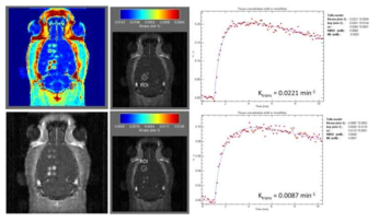 DCE-MRI 기법을 이용한 뇌혈관 투과율 측정 방법