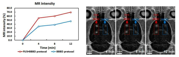 MRI와 조영제의 intensity 비교