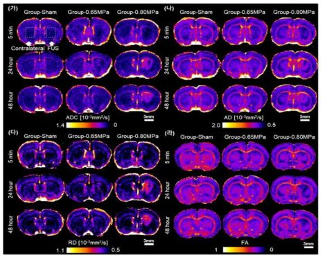 BBB 개통 후 5분, 24시간, 48시간에서의 DTI-MRI 통해 계산된 결과. (가) 평균 확산 계수 (Apparent Diffusion Coefficient; ADC) 지도, (나) 축삭 확산 계수 (Axonal Diffusivity; AD) 지도, (다) 방사 확산 계수 (Radial Diffusivity; RD) 지도, (라) 이등방성 (Fractional Anisotropy; FA) 지도