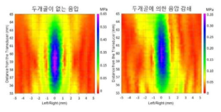 두개골 유무에 따른 음압 차이