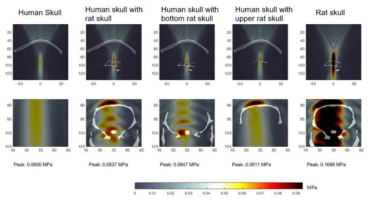 사람의 두개골 조각과 소동물 (Rat) 두개골 구조 정보를 결합하고, 0.25MHz의 초음파가 150μs 동안 조사되는 환경을 삼차원 집중초음파 시뮬레이션