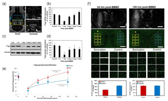 BBB 개통 후 시간에 따른 P-gp의 발현변화 확인. 집속초음파 조사에 따른 MR 영상(a), P-gp유전자 발현 (b), P-gp 단백질 발현 (c,d), kinetics 그래프 (e), 뇌조직에서 P-gp 발현 (f)