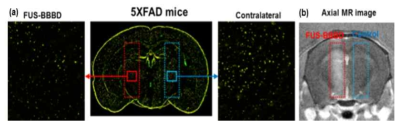 (a) 5XFAD Amyloid β plaque 염색 (b) T1-weighted axial MR image