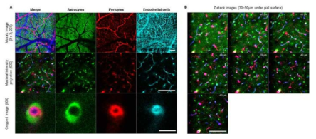 형광단백질 발현 동물 모델을 이용한 신경혈관단위 동시 영상화
