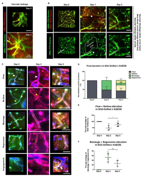 (a) microinfarction 유도 24시간 후, 2MDa FITC-Dextran과 3KDa TRITC-Dextran을 이용하여 vascular leakage를 확인함 (녹색, 2MDa FITC-Dextran; 빨강, 3KDa TRITC-Dextran). (b)　Microinfarction 유도 후, 5일동안 혈류 변화를 측정함. (c) NG2-DsRed x Kaede 마우스를 이용하여, 혈관 위주의 변화를 확인함 (녹색, Kaede; 빨강, transformed Kaede; 파랑, Blood flow, Dextran-Alexa 647). (d-f) 위 마우스에서 확인된 혈류의 유지, re-flow, 혈관 막힘, 혈관 퇴행변화를 정량분석을 진행하고, microinfarction 유도 후 5일 동안 변화된 총 혈류의 유지 및 소실 부분으로 나누어 확인함