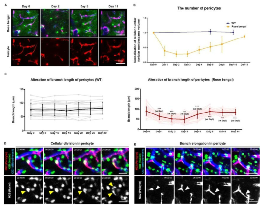 (a, b) infarction 유도 후 pericyte를 확인하고 세포수를 정량화함 (녹색, Aldh1l1-GFP, Astrocyte; 빨강, NG2-DsRed, Pericyte; 파랑, Endothelial cell, CD31 labeling). (c) Pericyte branch 길이를 정량함. (d, e) NG2-DsRed x H2B-GFP마우스를 이용하여, infarction를 유도 후 3.5일 시점에 24시간 영상화를 진행함 (녹색, H2B-GFP, 세포핵; 빨강, NG2-DsRed, Pericyte; 파랑, Endothelial cell, CD31 labeling)