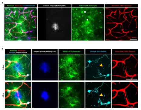 (a) 퇴행성 뇌질환 모델에서 신경혈관단위의 미세구조 변화를 확인하기 위하여, NG2-DsRed x Aldh1l1-GFP x APP/PS1를 확립하고, 5.5개월에 영상화를 진행함. Methoxy-X04를 이용하여 amyloid plaque를 염색함. (b) 5.5개월과 6.5개월 시점에 신경혈관단위를 영상화하고, TRITC-Dextran를 주입하여, 혈류를 확인함
