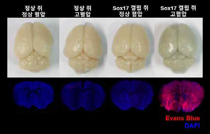 고혈압을 유도한 Sox17 결핍 생쥐에서 뇌혈관장벽 붕괴가 발생