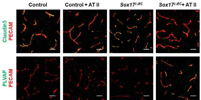 고혈압 Sox17 결핍 생쥐에 서 Claudin5의 발현 감소 및 PLVAP 발현 증가