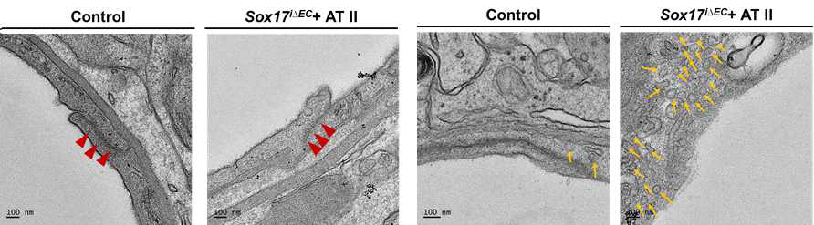고혈압 Sox17 결핍 생쥐에서 발생한 tight junction (붉은색 쐐기) 의 loosening 및 현저한 vesicular activity (노란색 화살표) 의 증가