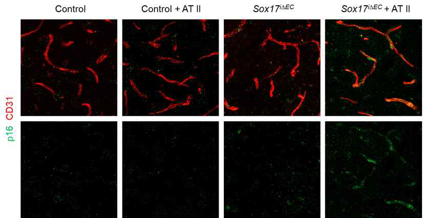 Sox17 결핍 + Angiotensin 주입 생쥐의 혈관에서 확인된 노화 마커 p16ink4a의 발현 증가