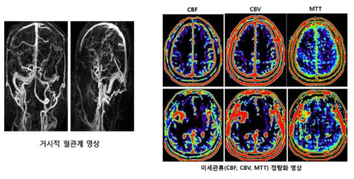 혈류신호모델 기반 비선형 영상복원 기술을 통한 거시적 혈관계 및 미세관류 동시 정량화 영상