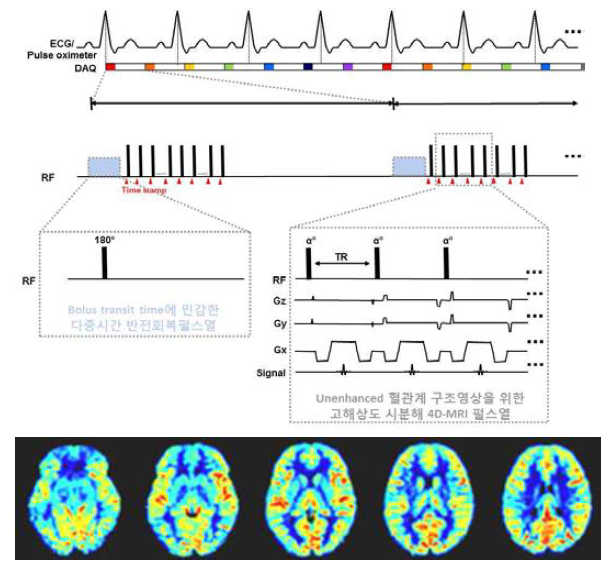 개발된 Bolus transit time에 민감한 다중반전 회복 기반 동적스핀 표지 4D-MRI 펄스시퀀스 및 해당 MRI 펄스열을 통해 획득한 동적스핀표지 영상