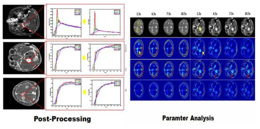 시공간 해상도 변화에 따른 혈뇌장벽 누출 패러미터(Ktrans) 추정 과정 및 정량화 영상