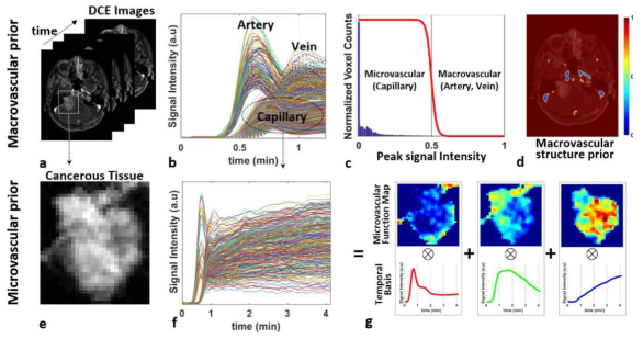 시간에 따라 획득하는 4D 혈관계 영상 데이터 (a), 조직에서 혈관계 다형성을 나타내는 시간에 따른 영상신호 변화 (b)와 히스토그램 (c), 거시적 혈관계 지도 (d), 질병 관련 영상 (e), 질병 조직에서 시간에 따라 변하는 미세혈관계 신호강도 (f), 미세혈관계 세분화를 위한 대표 신호강도 추출 과정
