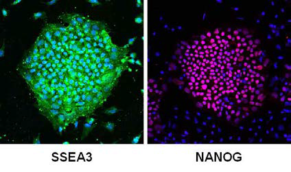 역분화줄기세포 colony들을 SSEA3, NANOG으로 염색함. 전체적으로 균일한 염색 패턴을 보이는 것을 관찰할 수 있음