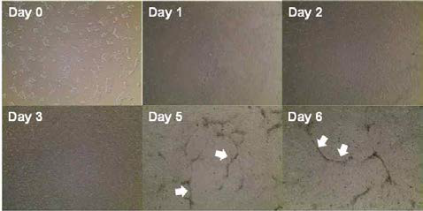 역분화줄기세포(day 0)가 UM에서 배양되면서, endothelial progenitor와 neural progenitor(화살표)로 같이 분화되어 가기 시작함