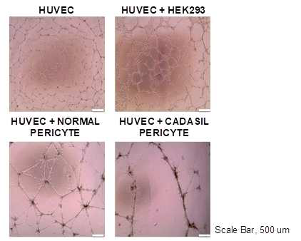 HUVEC 내피세포와 iPSc 유래 혈관주위세포 공배양을 통한 tube formation assay. 혈관 형성능을 관찰