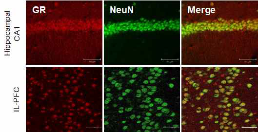 IL-PFC와 CA1에서 GR의 해부학적 구분을 위한 컨포칼 이미징