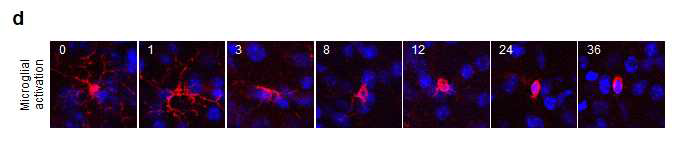 D) 신경염증 확인을 위한 Microglial 세포 활성