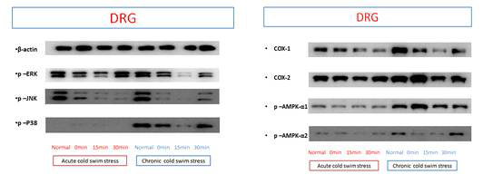 Acute와 chronic cold water swimming 스트레스 모델의 DRG에서 여러 signal 단백들의 발현 변화