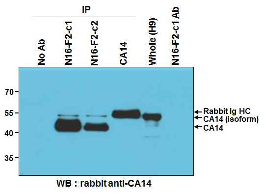 N16-F2 (c1 and c2) antigen analysis using commercial CA14 antibody. c1 과 c2, rabbit polyclonal anti-CA14 (GTX81537) 의해 면역침강된 CA14 를 anti-CA14 항체로 확인한 결과 rabbit 항체는 CA14 isoform 잘 결합하고, N16-F2 는 isoform 보다 45kDa 의 원래 형태를 더 잘 잡는 것을 볼 수 있음