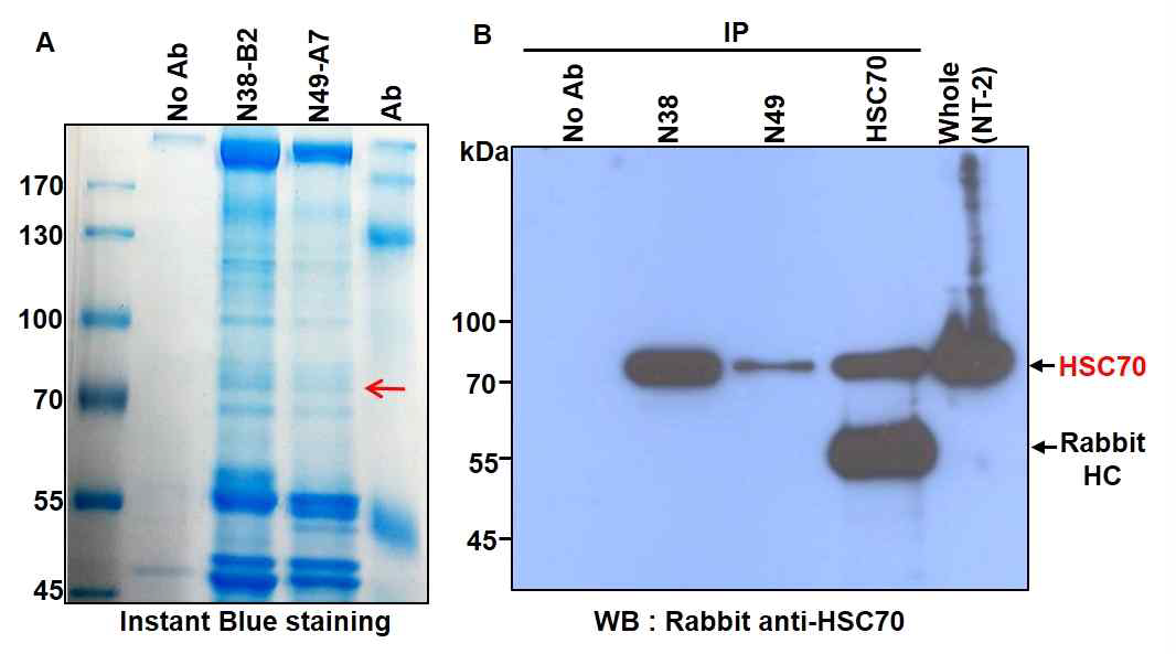 Identification of N49-A7 antigen. (A) 2102EP세포에서 N38-B2와 N49-A 면역침강하고 Instant Blue염색함. (B)N38-B2, N49-A7와 HSC70항체로 면역침강(IP)한 후 단백질을 HSC70 항체로 검출함 (검은 화살표)