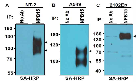 NPB15 항원의 동정. (A) NT-2, (B) A549, (C) 2102EP 세포에서 NPB15 항체에 의해 면역침강된 단백질