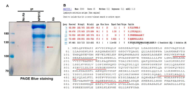 NPB15 항원의 동정. (A) NPB15에 의해 면역침강된 125kDa의 표면 단백질(A)을 PageBlue 염색 후 LC-MS/MS 분석을 통해 SLC3A2 (CD98hc)으로 동정하고 match되는 peptide의 아미노산을 표시함(적색)