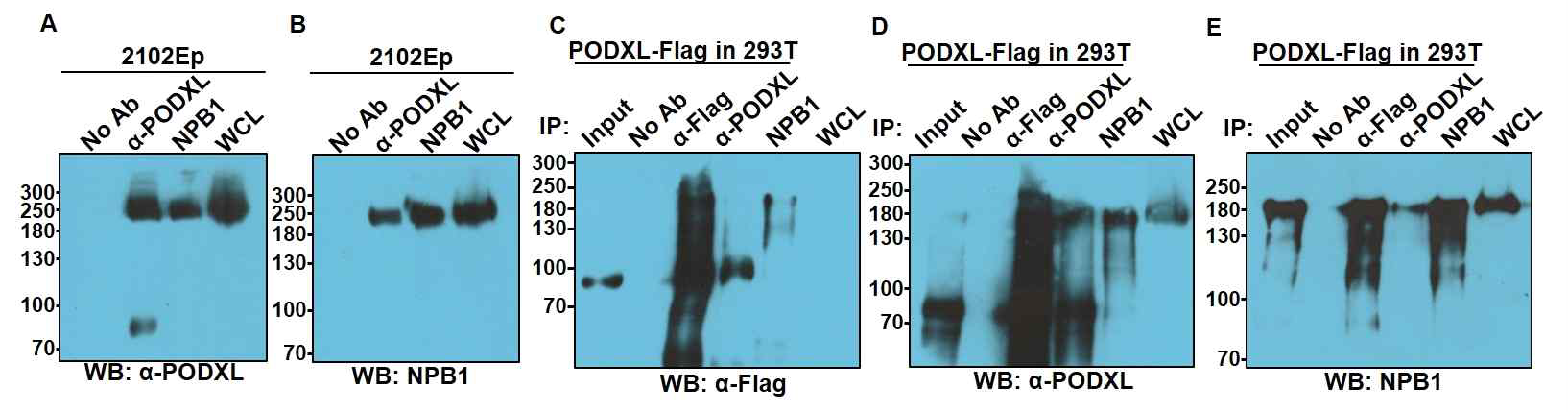 Antigen validation of NPB1. Fig. Antigen validation of NPB1. (A,B)상업적 mouse anti-PODXL 항체를 이용하여 NPB1과 anti-PODXL 항체가 면역침강 한 단백질을 각각의 항체로 검출함. (C-E) NPB1 항원이 podocalyxin인지 재확인 하기 위해 pCMV3-PODXL-Flag vector를 transfection 한 HEK293T 세포를 anti-Flag, anti-PODXL 및 NPB1 항체를 이용하여 면역침강 한 결과, NPB1 항체가 면역침강 시킨 항원이 anti-Flag과 anti-PODXL 항체에 의해 검출되고 anti-Flag과 anti-PODXL 항체가 면역침강 시킨 항원이 NPB1에 의해 검출됨을 보여줌