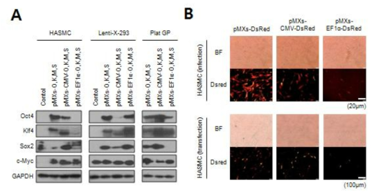 pMXs 레트로바이러스 벡터 기반 2중 프로모터에 의한 리프로그래밍 인자 발현. A) Western blot에 의한 전사인자 발현 확인. B) 형광 이용 프로모터 발현 측정