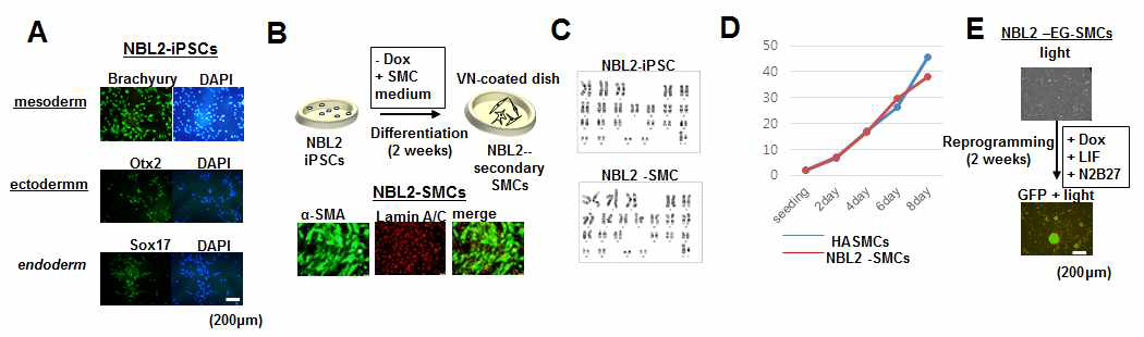 NBL2-iPSC로부터 리프로그래밍 세포주 수립. A) NBL2-iPSC의 in vitro 삼배엽 분화. B) NBL2-iPSC의 SMC 분화 모식도. C) karyotype analysis. D) NBL2-SMC의 성장도 조사. E) NBL2-EG-SMC의 리프로그램능 조사