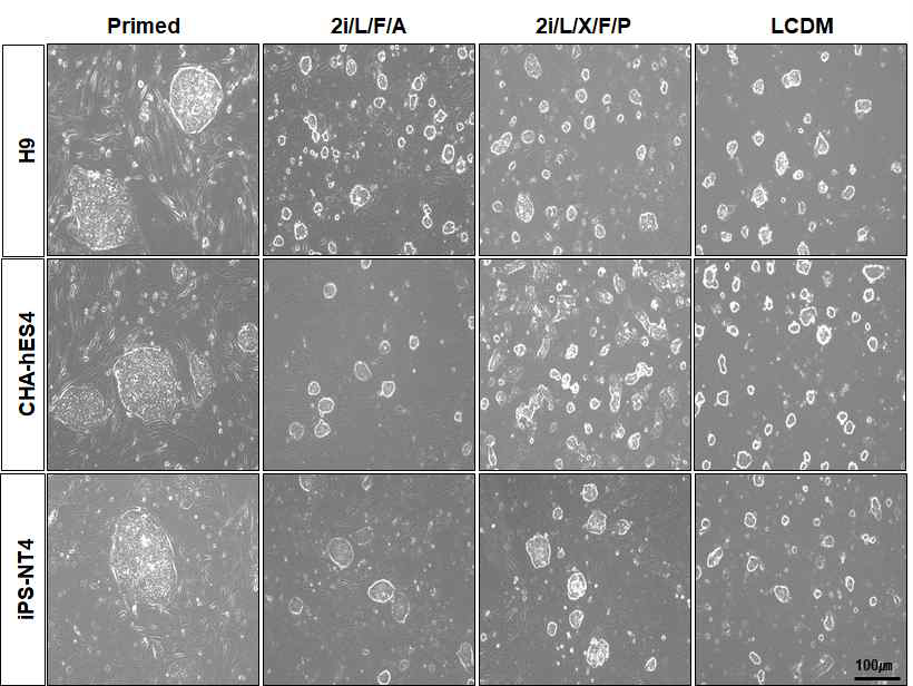 hPSC배양에서 primed과 naive media에서 형태비교. Primed H9, CHA-hES4와 iPS-NT4 세포는 크고, 납작한 형태의 colony (large and flat colony) 모양을 보이지만, naive로 전환시킨 2i/L/F/A, 2i/L/X/F/P와 LCDM media에서 배양한 세포는 상대적으로 작고, 촘촘한 dome 형태의 colony (small and compacted dome-shape colony)를 보임