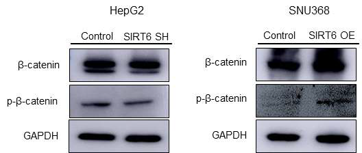 간암세포주 HepG2와 SNU368에서 SIRT6 silencing 및 overexpression 후 시간에 따른(0, 24h, 48h, 72h) b-catenin signaling 변화 연구