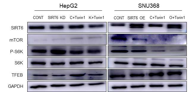 간암세포주 HepG2와 SNU368에서 SIRT6 silencing 및 overexpression 후 Torin1을 처리한 후 mTOR 관련 signaling 변화 연구
